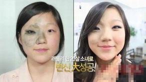 一起去韩国整容